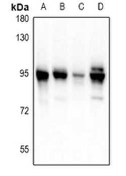 Anti-PDXDC1 Antibody