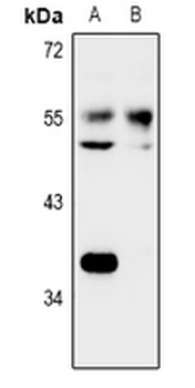 Anti-NARFL Antibody