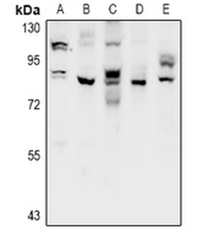 Anti-CSGLCAT Antibody