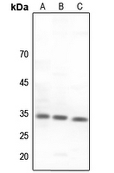Anti-CNOT7 Antibody