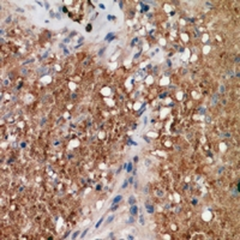 Anti-ALPK1 Antibody