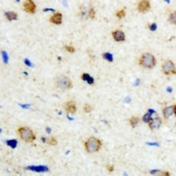 Anti-ICK Antibody