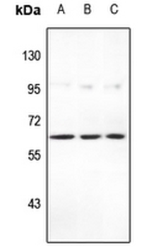 Anti-STEAP2 Antibody