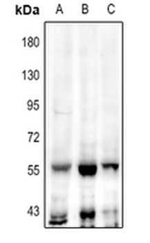 Anti-TEAD2 Antibody