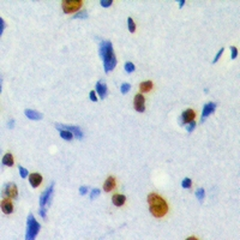 Anti-MKI67IP (pT234) Antibody