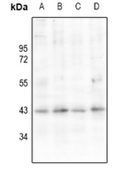 Anti-AT1 Antibody