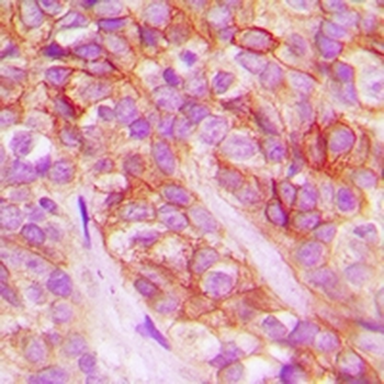 Anti-AT1 Antibody
