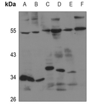 Anti-EDG5 Antibody