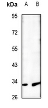 Anti-MTIF3 Antibody