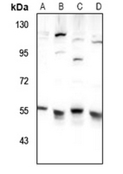Anti-TIGD3 Antibody