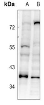 Anti-SRSF8 Antibody