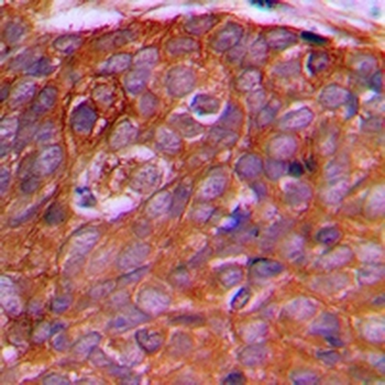 Anti-PEX2 Antibody
