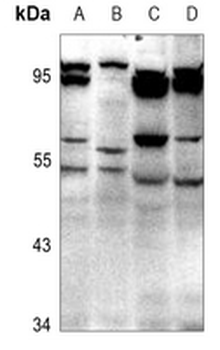 Anti-GABRD Antibody