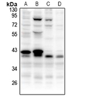 Anti-CCNB1IP1 Antibody