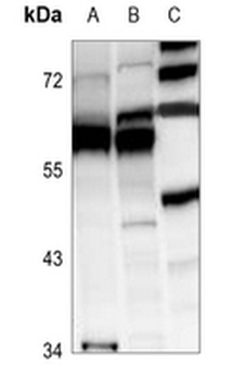 Anti-DDX19B Antibody