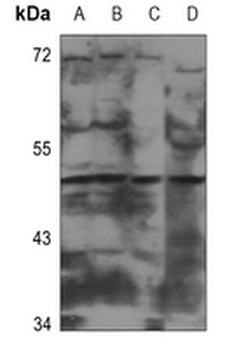 Anti-CADM2 Antibody