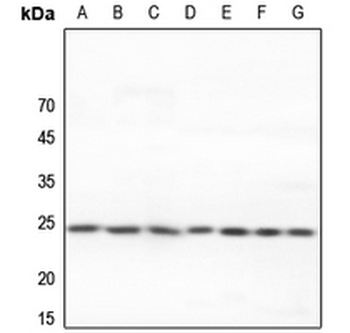 Anti-Adenylate Kinase 6 Antibody
