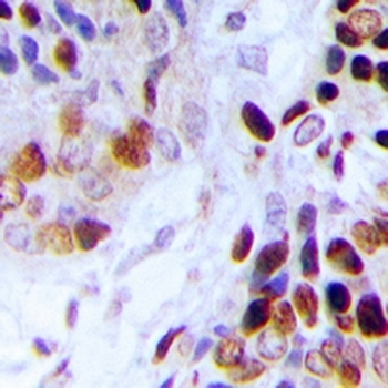 Anti-Adenylate Kinase 6 Antibody