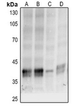 Anti-p38 (pT180/Y182) Antibody