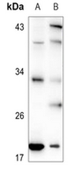 Anti-TCEAL1 Antibody