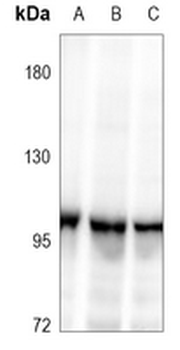 Anti-XRN2 Antibody