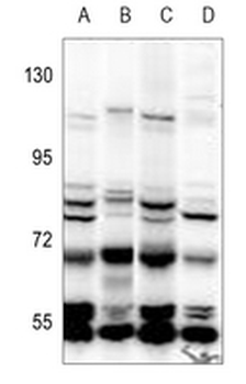 Anti-NIPA Antibody