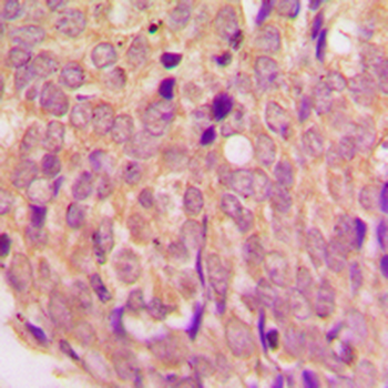 Anti-WASF1 Antibody