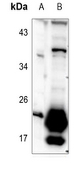 Anti-TUSC5 Antibody