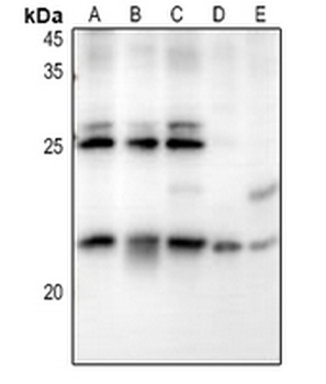 Anti-RB3 Antibody