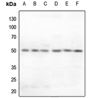 Anti-Secretin Receptor Antibody