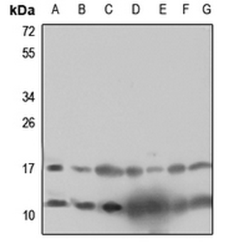 Anti-RPL12 Antibody