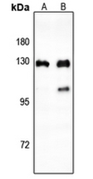 Anti-CTIP Antibody