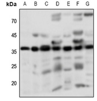 Anti-PGD2 Receptor Antibody