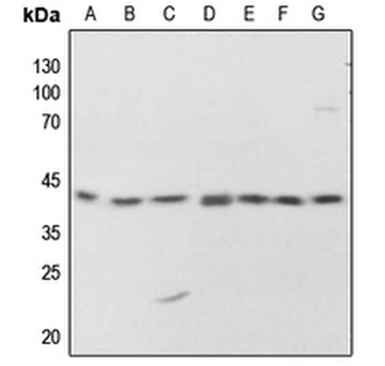 Anti-PKA C alpha/beta/gamma (pT198) Antibody