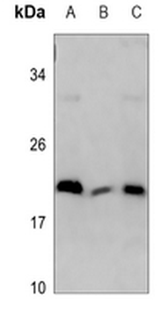 Anti-MRPL18 Antibody