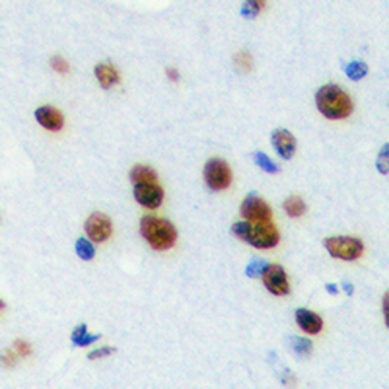 Anti-TRAP100 Antibody