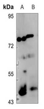 Anti-c-Jun (pS73/100) Antibody