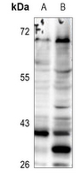 Anti-ELOVL5 Antibody