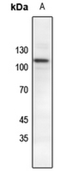 Anti-Catenin delta 1 (pY228) Antibody