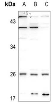 Anti-CMPK1 Antibody