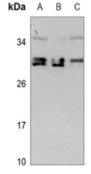 Anti-CDCA4 Antibody