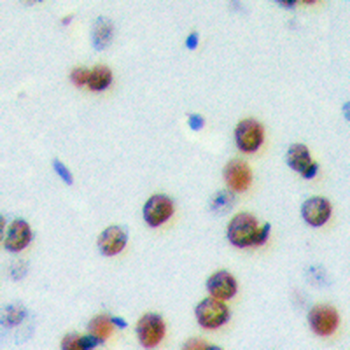 Anti-CDCA4 Antibody