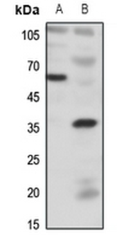Anti-BDKRB1 Antibody