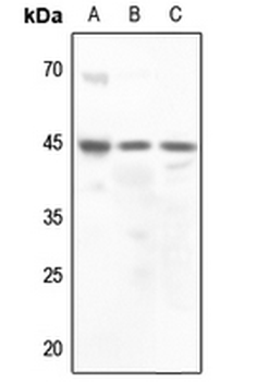 Anti-Vasopressin V2 Receptor Antibody