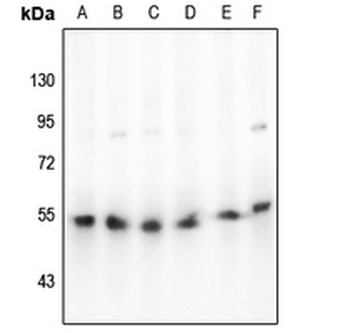 Anti-Beta-arrestin-1 Antibody