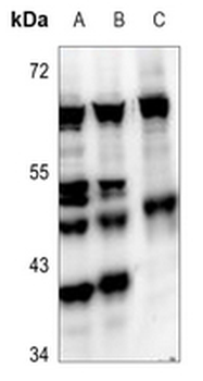 SMYD2 Antibody