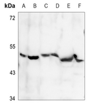 Anti-PDK2 Antibody