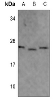 Anti-MRPL40 Antibody