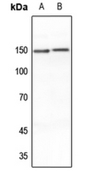 Anti-MEKKK6 Antibody