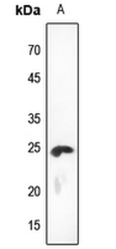 Anti-KDELR2 Antibody